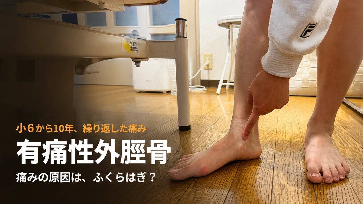 有痛性外脛骨の痛む場所を指さすイメージ（喜多見の整体院の症例記事）